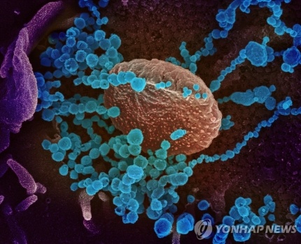 신종 코로나바이러스의 전자 현미경 사진[EPA=연합뉴스 자료사진]