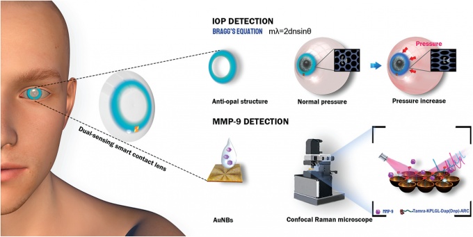 IOP 모니터링을 위한 안티오팔 구조와 MMP-9 검출을 위한 펩티드 기능화된 AuNB SERS 기질로 구성된 이중 기능 콘택트 렌즈 센서의 개략도.